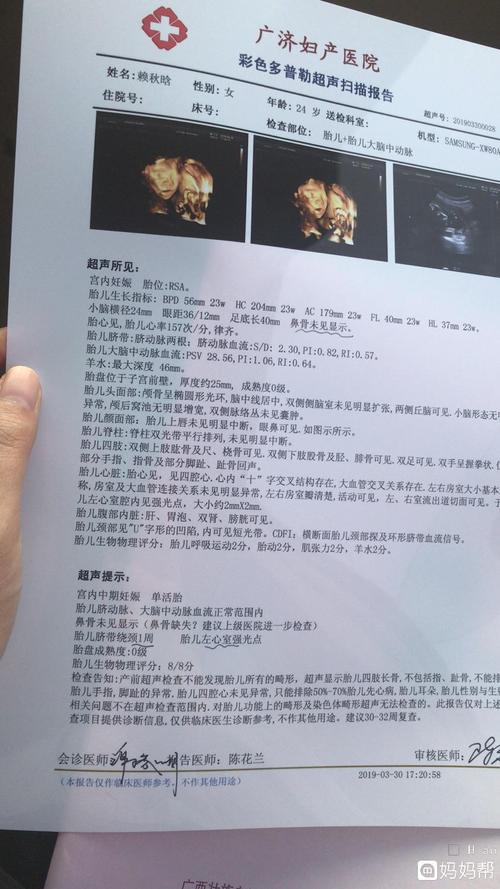 四维鼻骨缺失怎么办