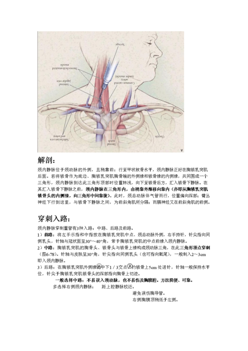 医药-颈内静脉穿刺.doc