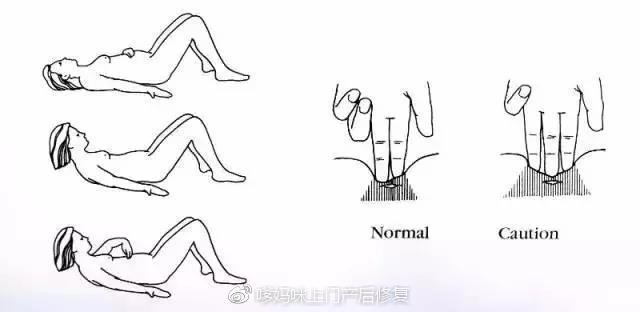 产后恢复迷人腰线,先自我检测下腹直肌分离程度(内附自检方法)