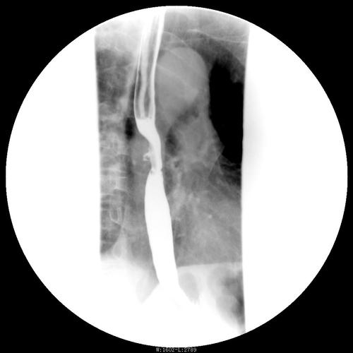 来试试上消化道造影