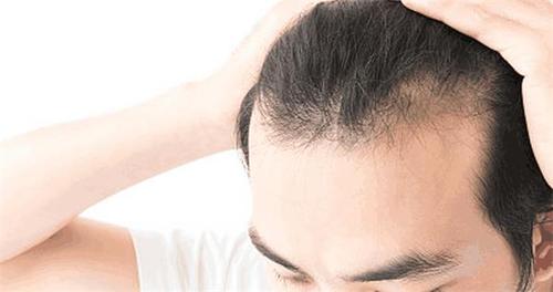 影响石家庄发际线下调价位的因素有哪些?