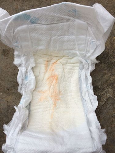 两个多月女宝宝尿不是上有红的 又不像是血是怎么回事?