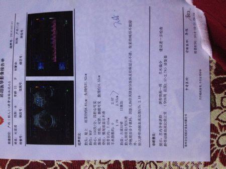 怎么看b超羊水指数