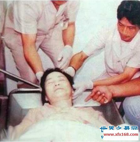 邓丽君死亡真相,尸检发现勒痕与巴掌印令人费解()