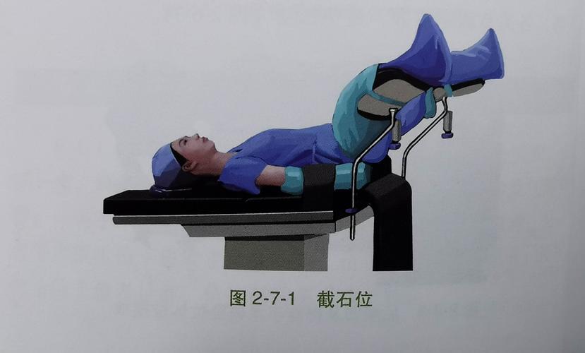 截石位