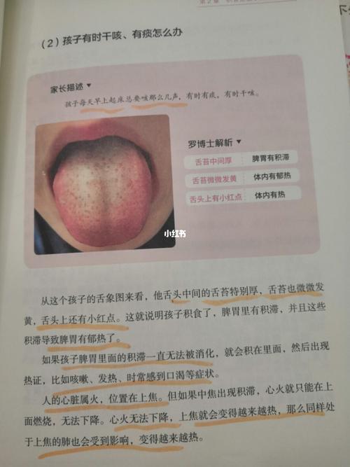 草莓舌和芒刺舌_口臭_便秘_医疗健康_医疗健康其他