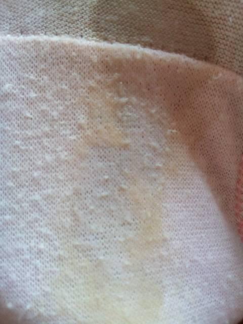 白带每天都这样正常吗.