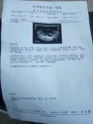 asea-卵巢癌案例