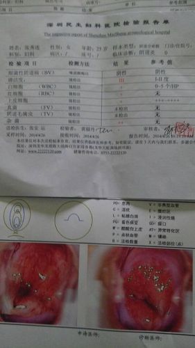 女性性病都有哪些症状会引起腰痛吗 肠粘连是什么症状,怎样引起的 肝