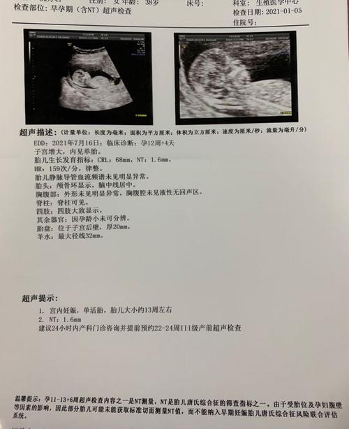 [试管婴儿]nt侧面,求大神们看看是男宝还