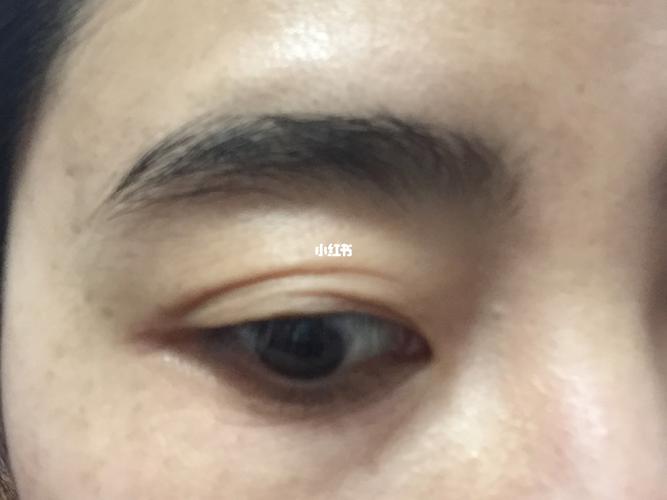 一夜之间突然长出多条眼纹,到底什么原因_眼纹_失眠_美妆_护肤_护肤