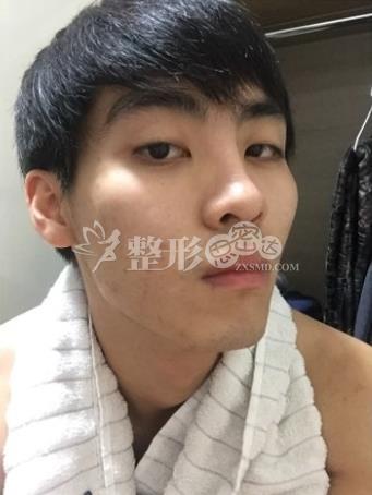 这张照片也是,颧骨突出每次自拍完就不由得自问, 为啥