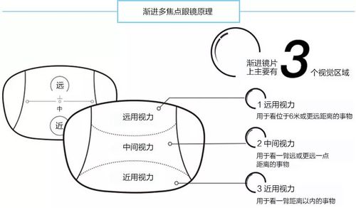 2.渐进多焦点镜片可细分为