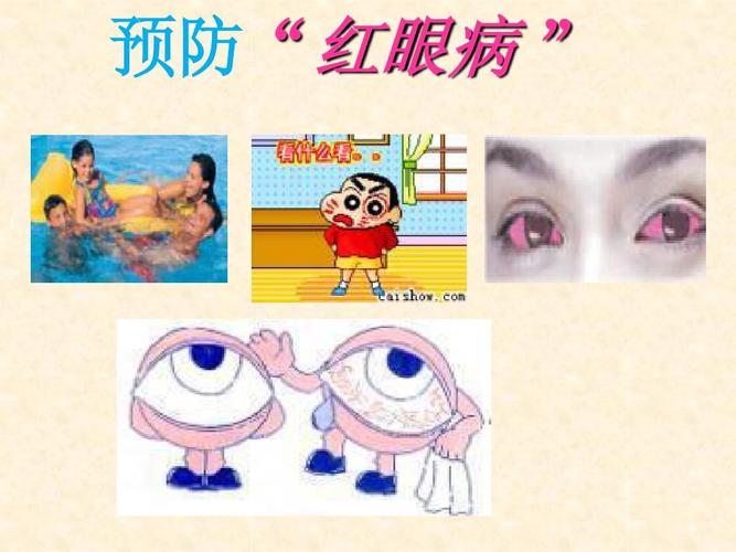 预防红眼病