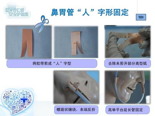 常见导管固定方法ppt