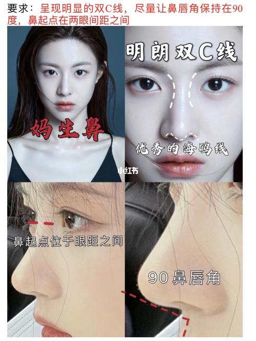 做肋骨鼻前的功课75少走弯路75(内含模板)_鼻子_肋骨鼻_唇角_自然