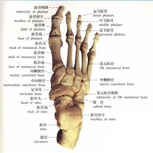 先天性垂直距骨切开复位和软组织松解术