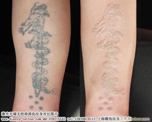 上海长宁区哪里纹身洗纹身比较好价格还便宜