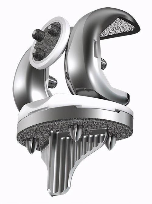 骨科机器人辅助全新生物型人工膝关节置换术