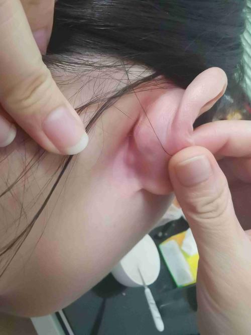 耳朵后面有个小包,压疼