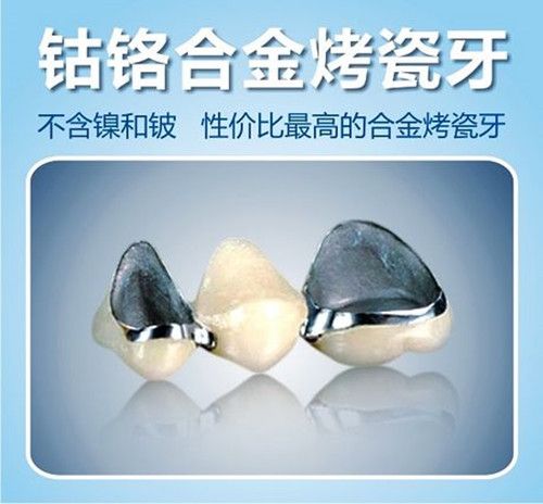 舒适度也比较高,是目前比较理想的镍铬合金烤瓷牙替代品