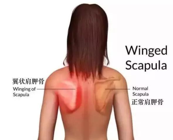 颈椎疼痛与肩胛骨有关系吗3个动作可缓解