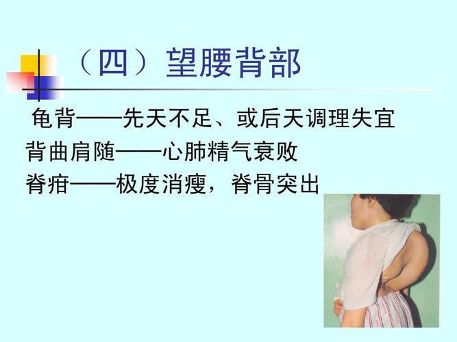 不足,或后天调理失宜 背曲肩随——心肺精气衰败 脊疳——极度消瘦