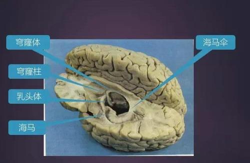 的结缔组织间隙和通道,感染时炎症等易于相互蔓延颅腔内有脑及脑神经