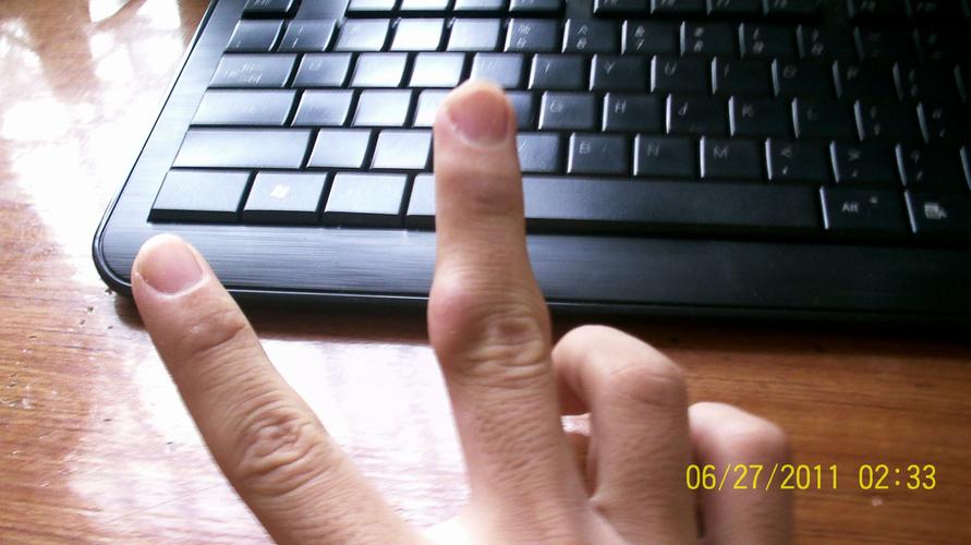 手指关节处囊肿