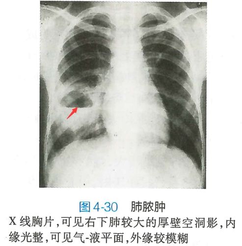 内容来源教材网络,如有侵权删 ①气液平面