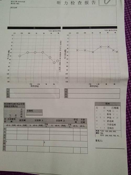 谁帮忙看下这个医院的听力检查报告,真心没弄懂,求解释.