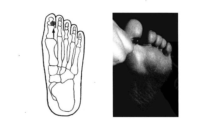 足底反射区之小脑