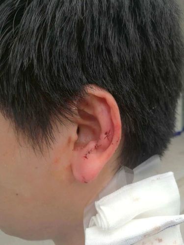 醉后"咬耳朵",抓了!