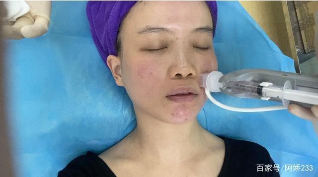 什么竟然有人不适合打水光针