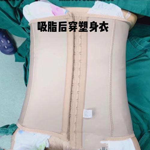 记录我的腰腹吸脂恢复过程图需要多久才能没有疼痛感