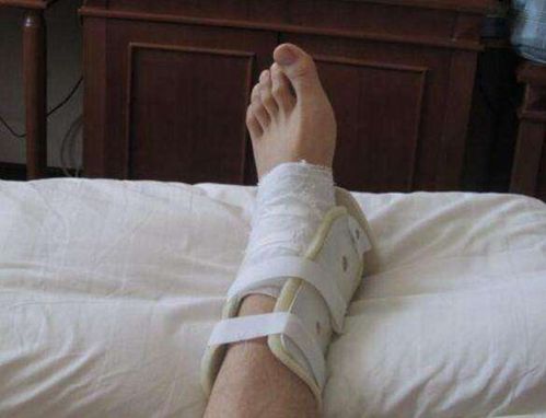 骨折介绍_骨折病因_骨折治疗_骨折医院医生_有来医生