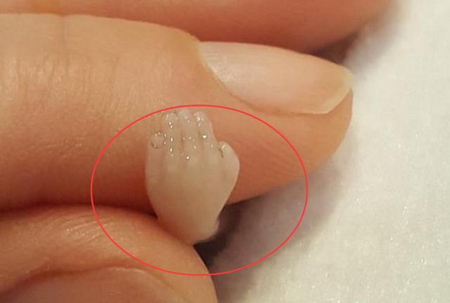 "14周流产胎儿"照片,10厘米大小已成型,看完你还堕胎吗?