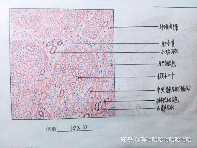 病理学红蓝铅笔图