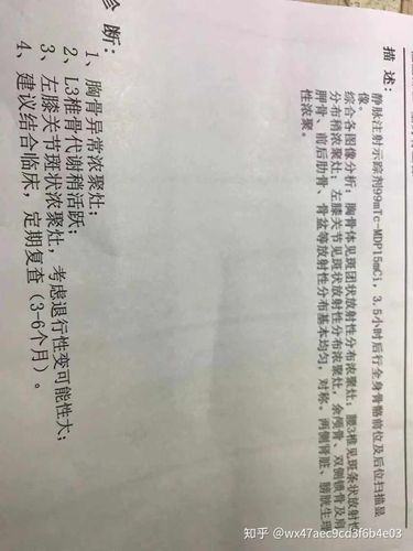 下面是淋巴穿刺报告,非常痛,做这个