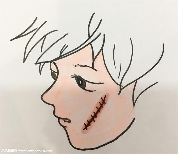 伤疤的简笔画教程