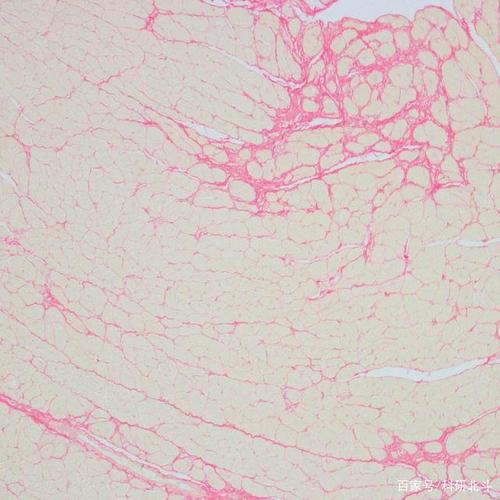 3分钟快速了解病理切片常用染色方法
