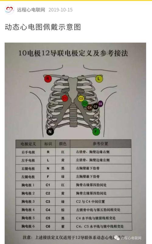 进行动态心电图监测,应配合医生提前排除过度通气,高血压,左室肥厚,预