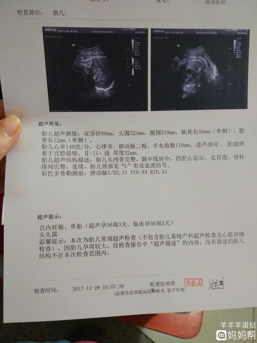 六个月的四维彩超和36周的彩超