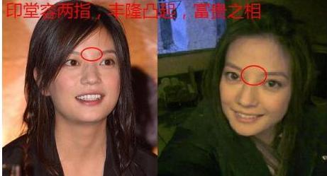 印堂丰隆的人,是一个圆满富贵人,此人一生容易获得成功与财富,生活上