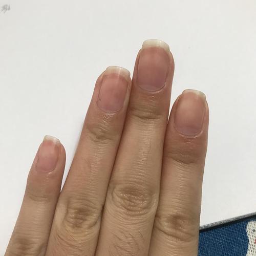 甲床越来越短了!