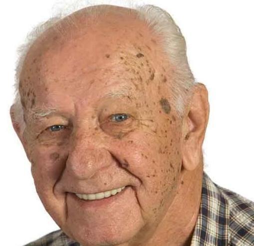 有的人老了长出老年斑?而有的老人脸上却干干净净,原因是什么?