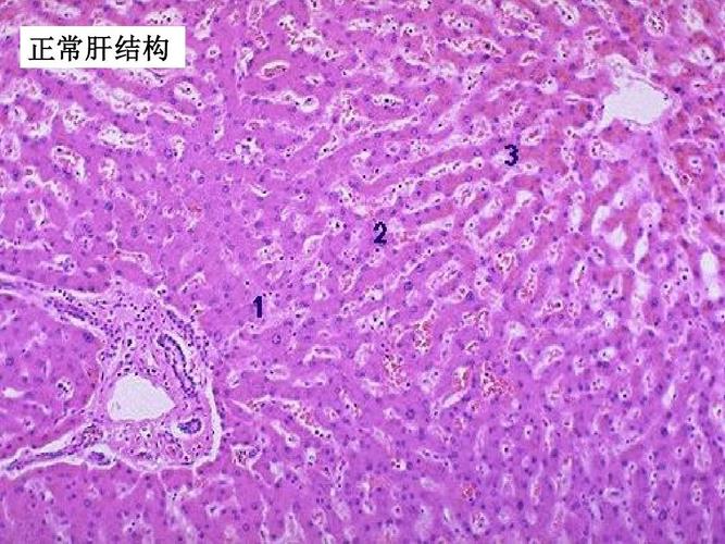 病理切片复习答案ppt