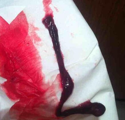 如果月经量超过人家都计算好了自己要在这几天来大姨妈,所以这几天