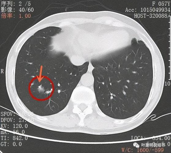 x线 x光 x光片 x线 640_573