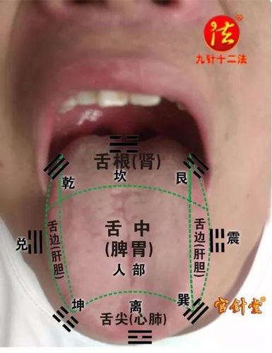 【中医望诊】全息舌诊,照镜子,看舌头,知体质,了知患者必备法门!